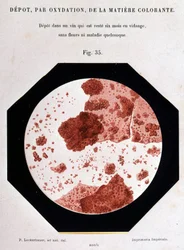 Depósito, por oxidación, de la materia colorante: depósito en una vista que ha estado vacía durante seis meses sin flores ni ninguna enfermedad. Vista microscópica 400/1. Estudio sobre el vino 1866 por Pasteur