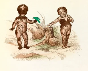 Niña cubierta de manchas peludas (grabado)