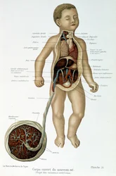 Medicina: recién nacido (desollado en el busto)