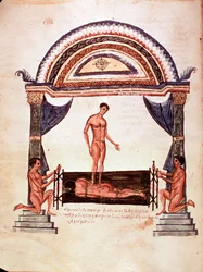 Medicina: reducción de una columna dislocada - el paciente está fijado en una tabla de madera, uno de los terapeutas se para sobre su espalda (manuscrito)