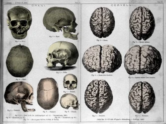 Las pieles y cerebros de hombres geniales. Estudio de Cesare Lombroso (1835-1909), criminólogo italiano en “El Hombre de Genio”