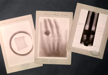 Radiografías originales de Roentgen (radiografía)