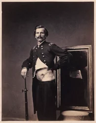 Mayor H. A. Barnum, Recuperación tras una herida penetrante de bala en el abdomen con perforación del ilion izquierdo, del Catálogo Fotográfico de la Sección Quirúrgica.