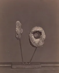 Articulación de rodilla excisada. Una bala de mosquete redonda en el cóndilo interno del fémur derecho, 1866-67
